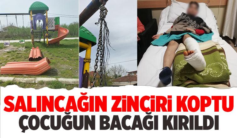 Salıncağın zinciri koptu bacağı kırıldı