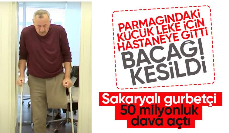 Parmağında küçük leke çıktı, bacağı kesildi