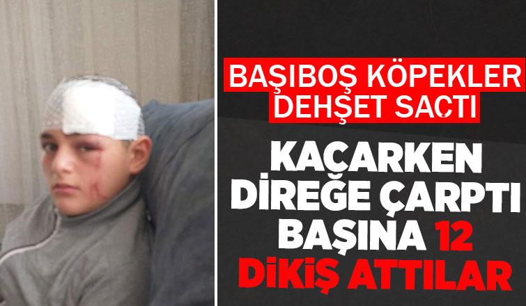 Başıboş köpekler çocuğu bu hale getirdi