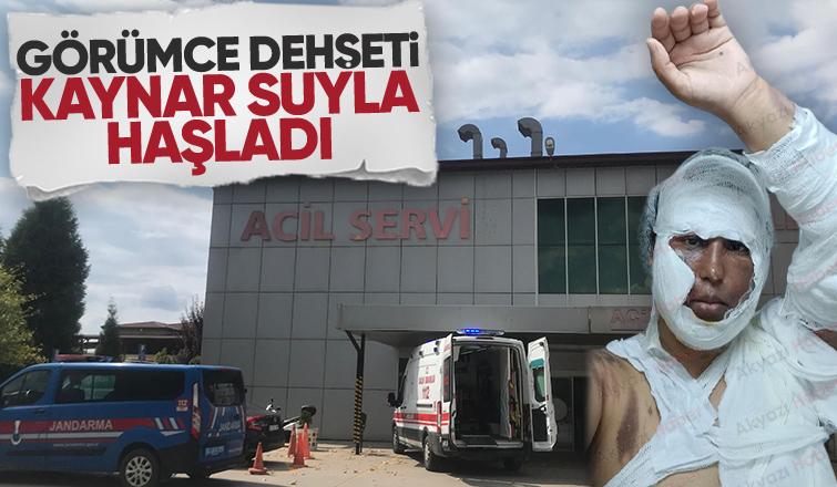 Görümce dehşet saçtı; Faslı kadını kaynar suyla yaktı