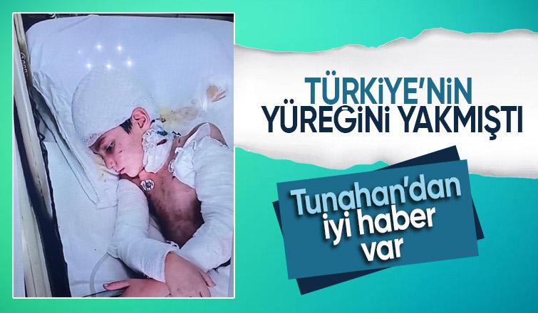 Köpeklerin saldırısına uğrayan Tunahan yoğun bakımdan çıktı