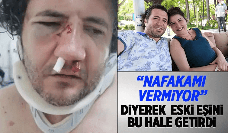 Nafaka Şiddeti, Eski Kocasını Dövdürdü  