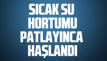 Sıcak su hortumu patlayınca haşlandı