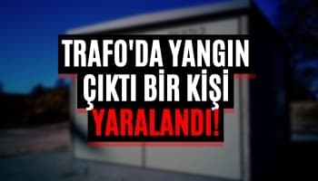 Trafo Bakımı Esnasında Yaralandı