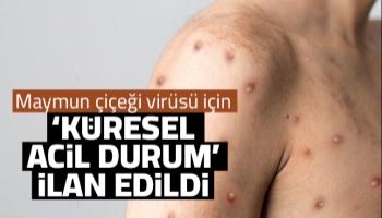 Maymun çiçeği için acil durum