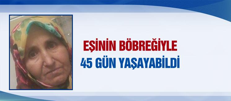 Eşinin böbreğiyle 45 gün yaşayabildi