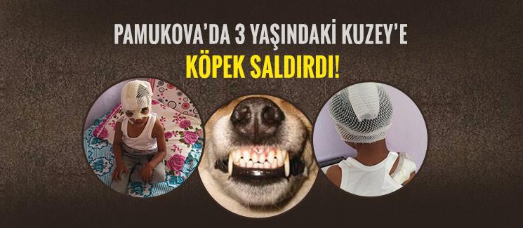 Pamukova'da 3 yaşındaki Kuzey'e köpek saldırdı