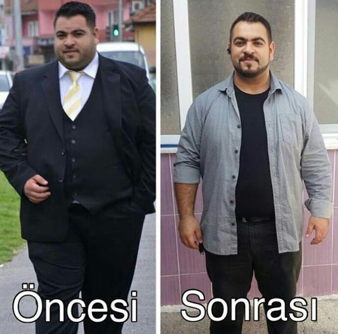 1 yılda tam 56 kilo verdi